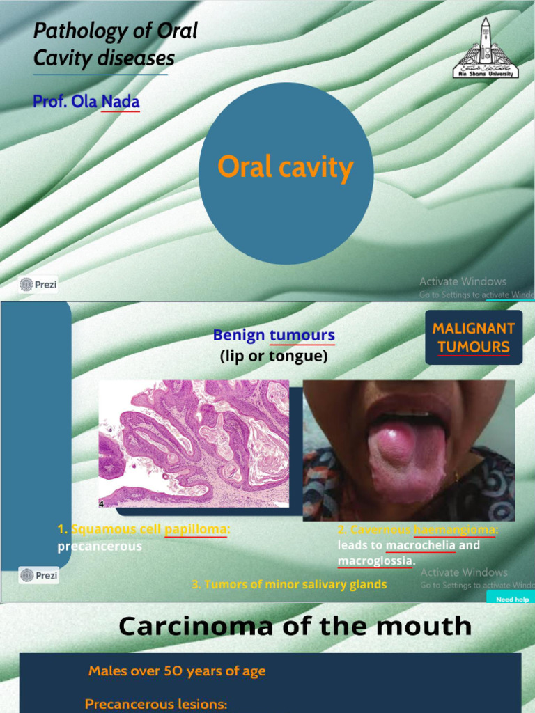Pathological Diseases of Oral Cavity Part Ii | PDF