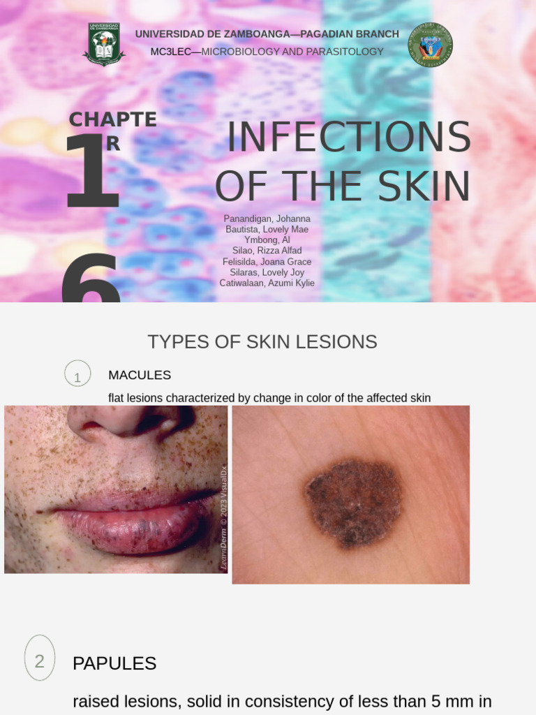 Infections of The Skin Chapter 16 | PDF