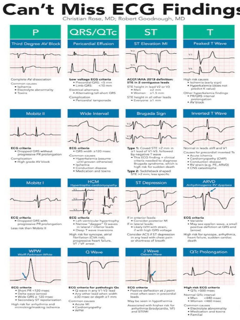 Ecg cant miss pdf