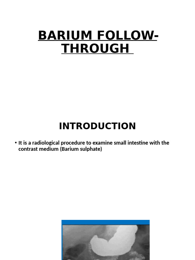 Barium Follow-Through Procedure Guide | PDF | Gastroenterology ...