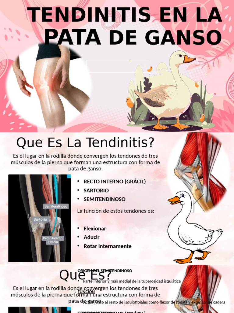 Terapia Para Aliviar La Tendinitis De La Pata De Ganso – LASY