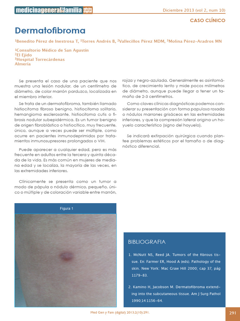 dermatofibroma-pdf