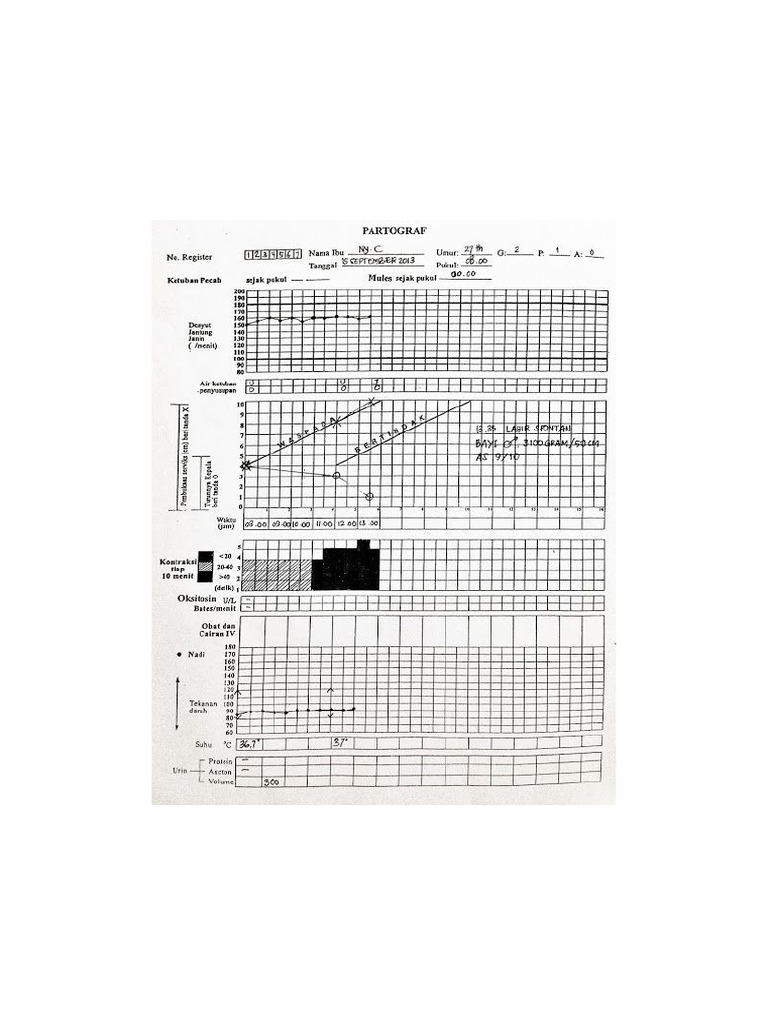 Partograf | PDF