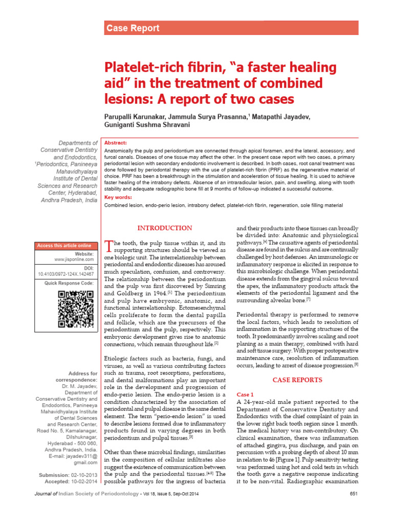 Platelet Rich Fibrin, A Faster Healing Aid In.23 | PDF