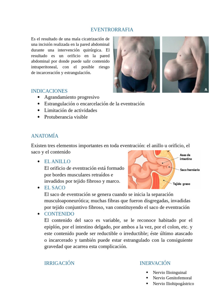 EVENTRACIÓN | PDF