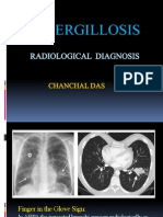 Aspergillosis: Radiological Diagnosis