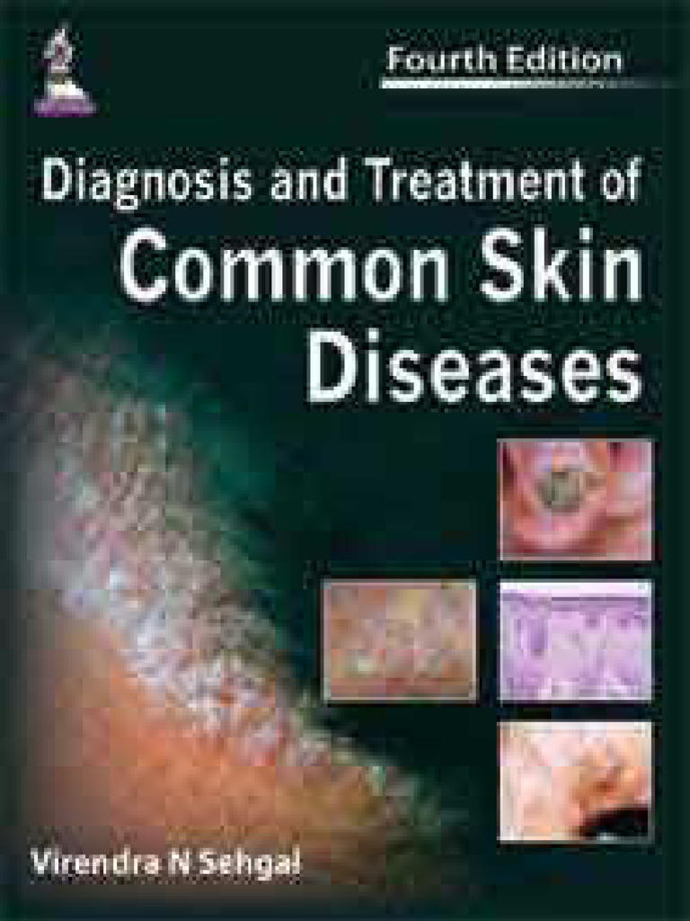Diagnosis and Treatment of Common Skin Diseases 4 Ediation | PDF