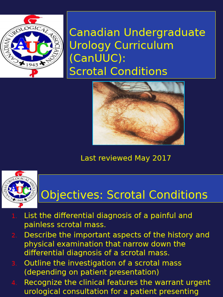 Canadian Undergraduate Urology Curriculum (Canuuc) : Scrotal Conditions ...