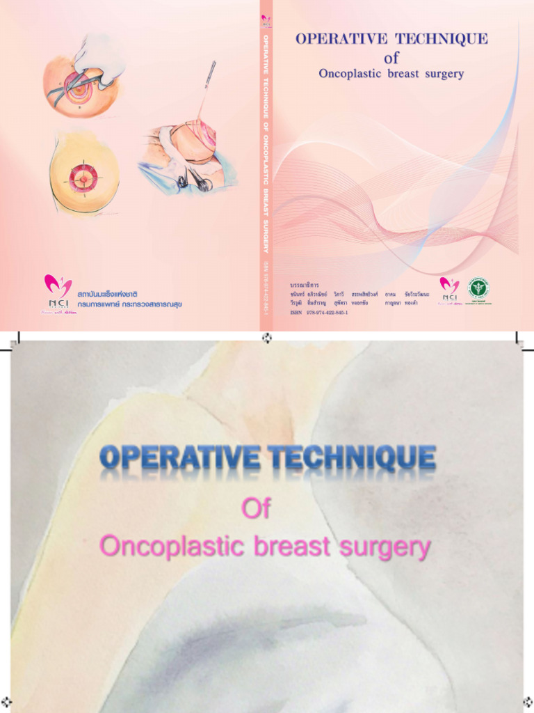 Operative Technique | PDF