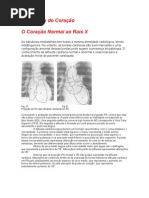 Radiologia do Coração