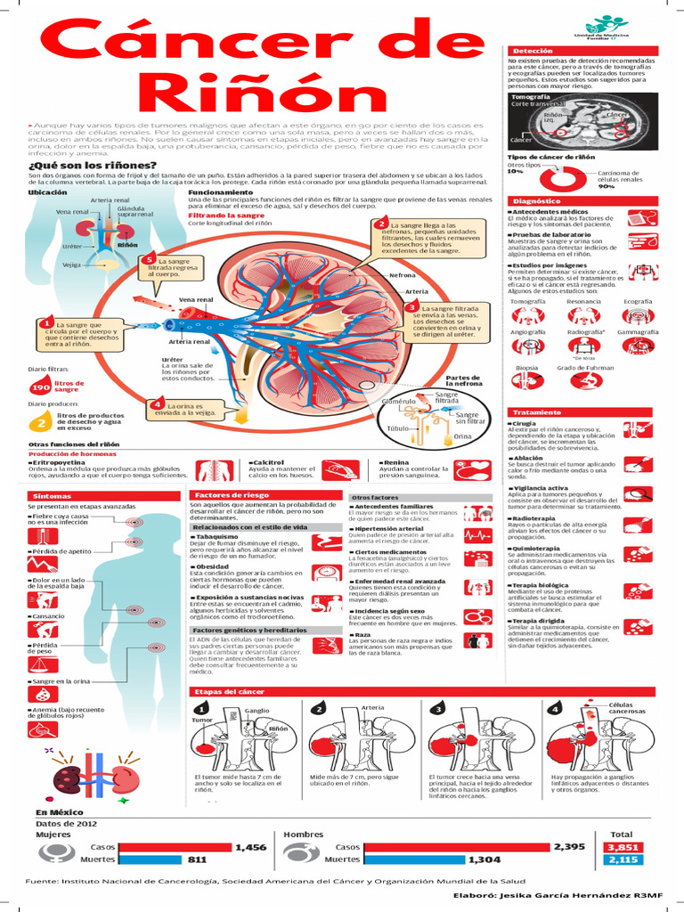 Cancer de Riñon | PDF