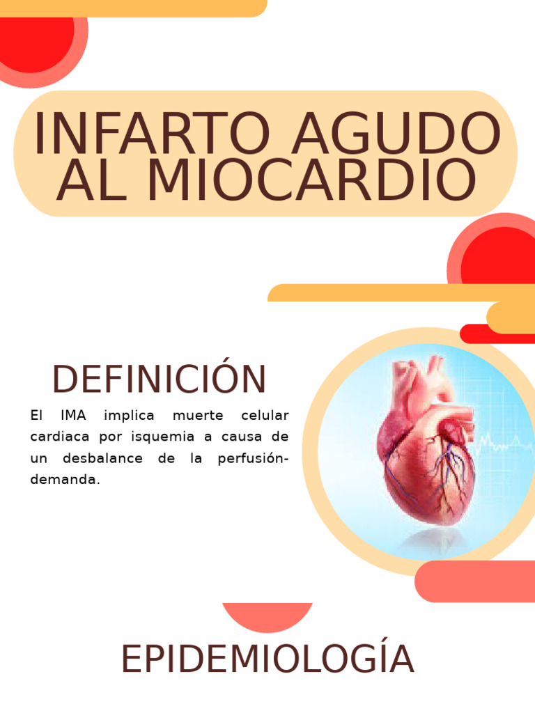 Infarto Agudo Al Miocardio | PDF