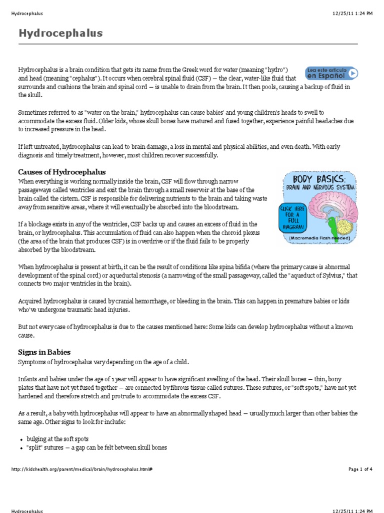Hydrocephalus 2 | PDF | Cerebrospinal Fluid | Medical Imaging
