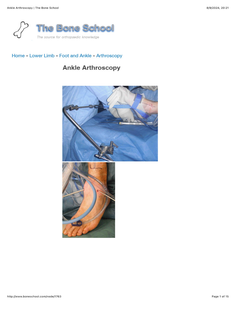 Ankle Arthroscopy - The Bone School | PDF | Ankle | Foot