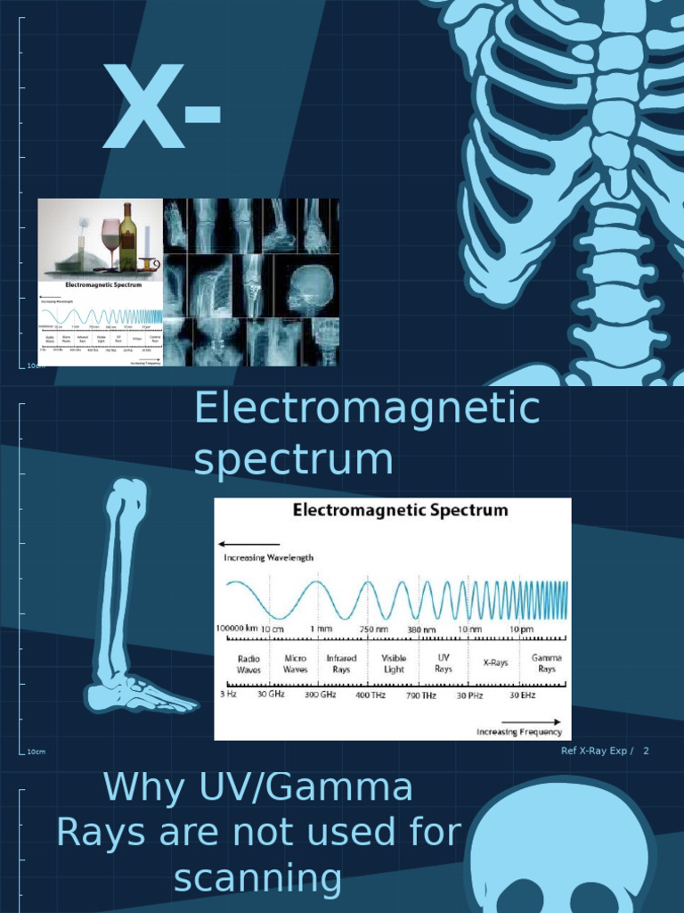X Ray | PDF