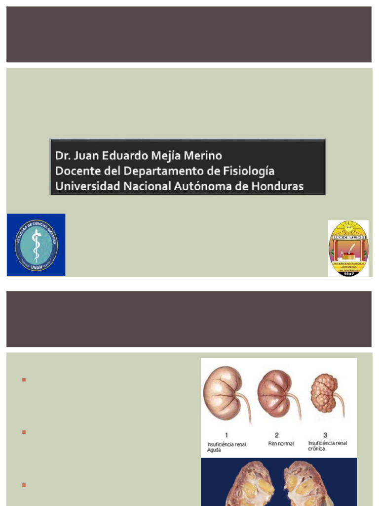 Insuficiencia Renal Crónica (Irc) | PDF