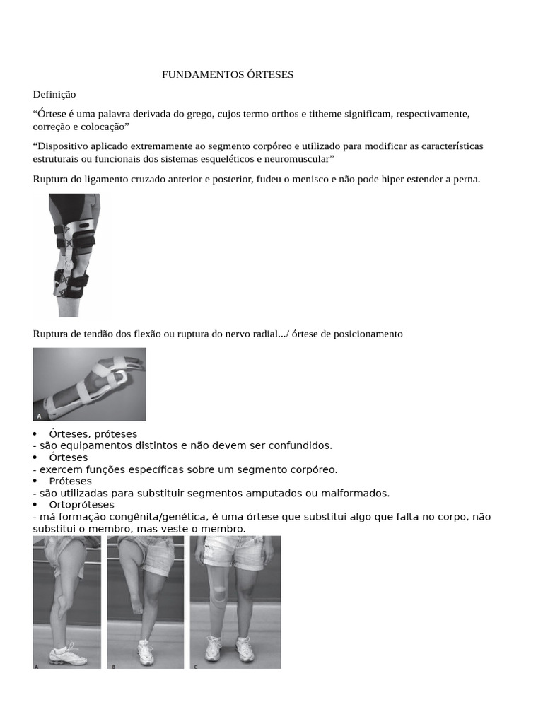 Órtese | PDF