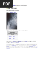 Download Osteoporosis by jobinbionic SN7674953 doc pdf