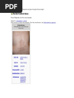 Download Scleroderma by jobinbionic SN7674966 doc pdf