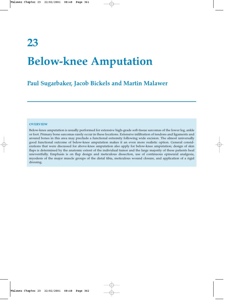 Below-Knee Amputation Techniques | PDF | Amputation | Prosthesis
