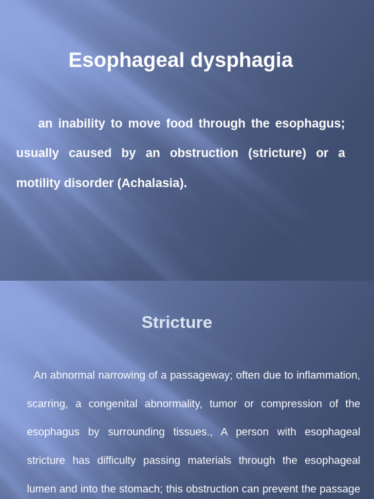 Esophageal Dysphagia | PDF