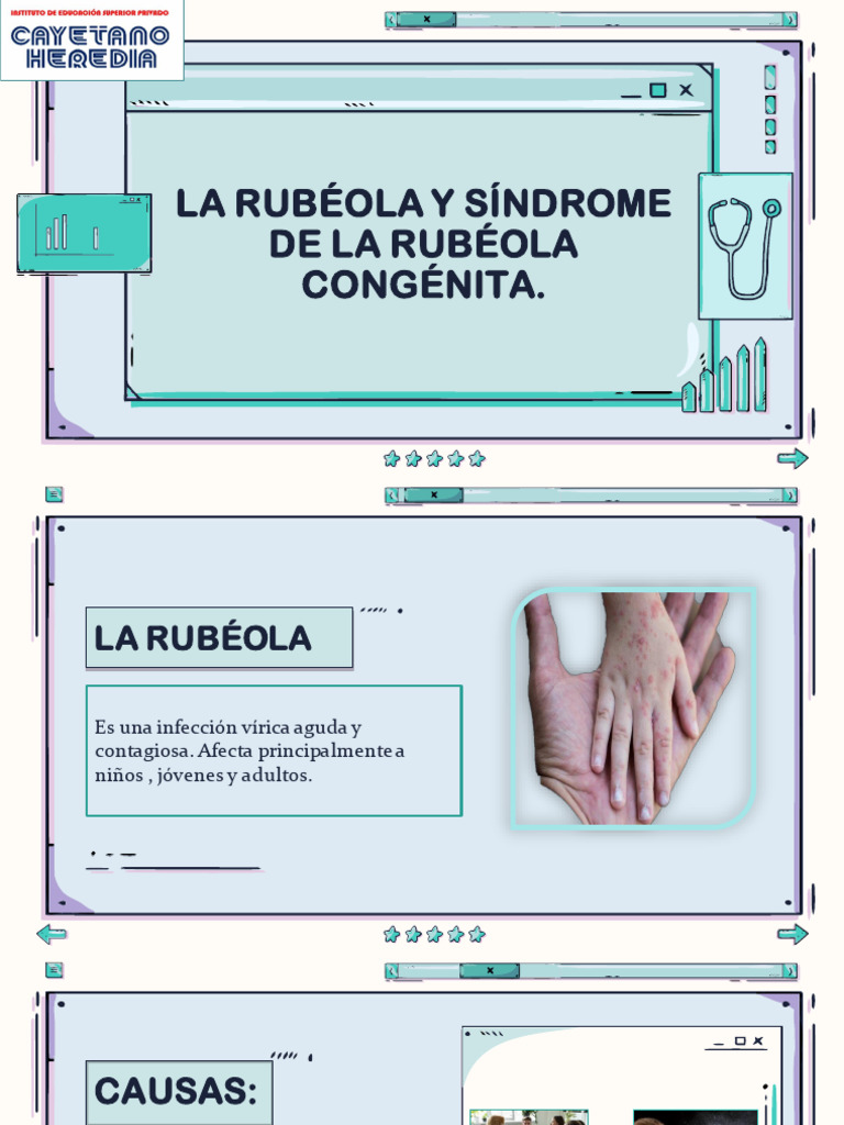 La Rubeola y Sindrome de La Rubeola Congenita.2 | PDF