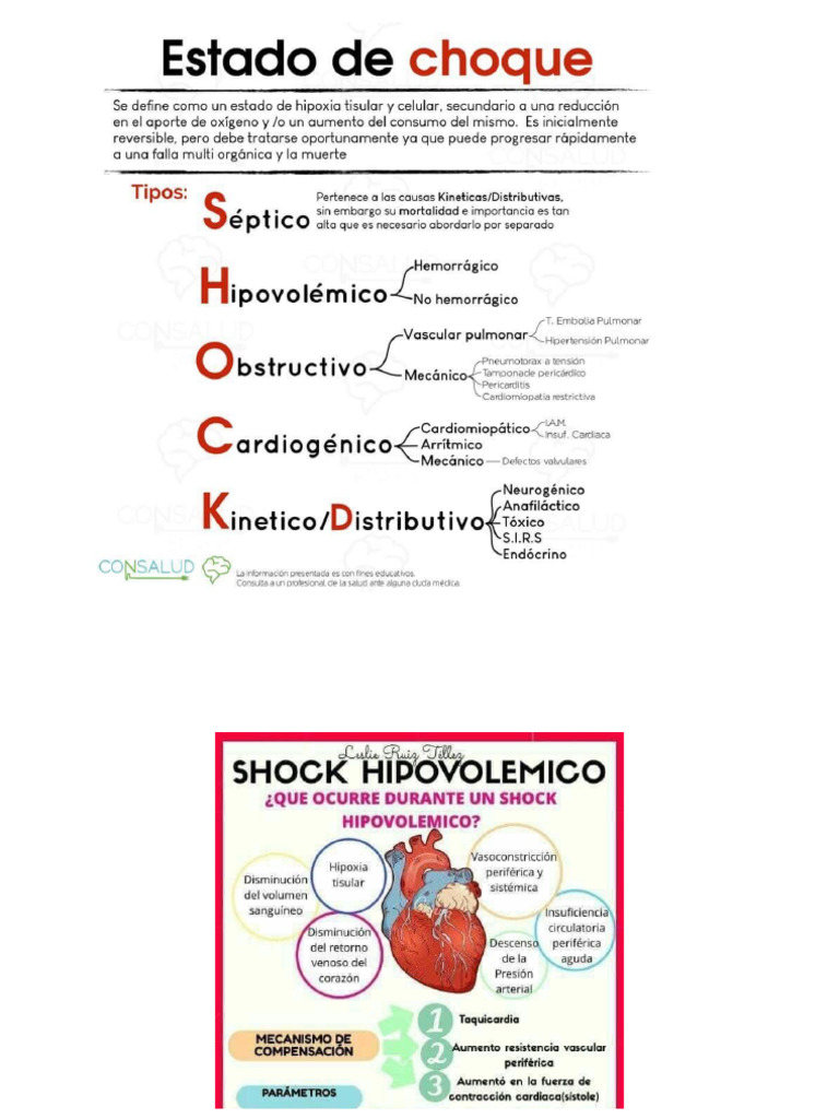 Tipos de Choques | PDF