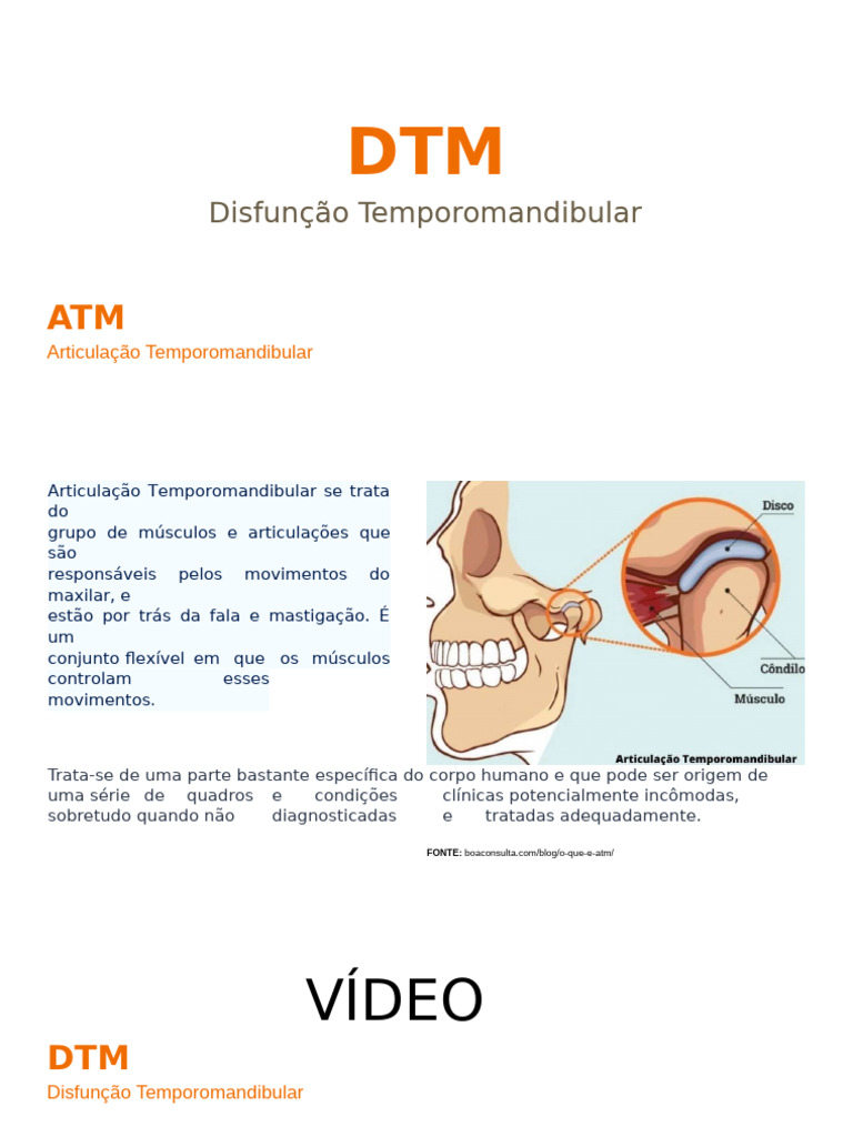 Seminário DTM | PDF