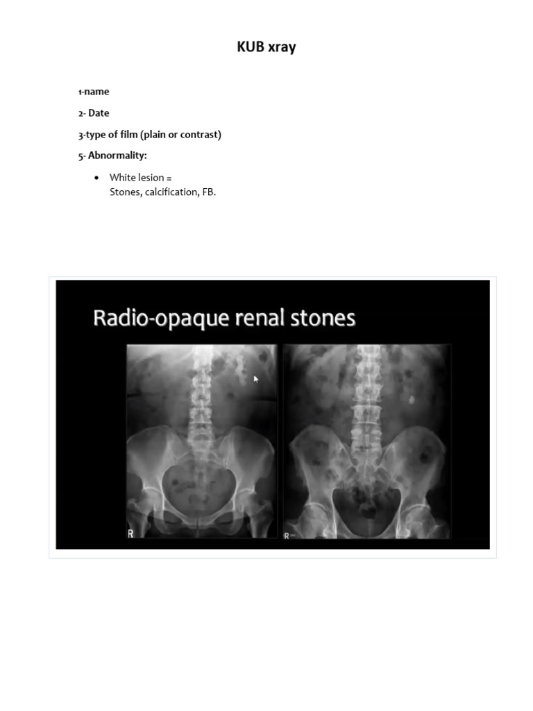 Kub xray 1 name 2 date 3 type of film plain or contrast 5