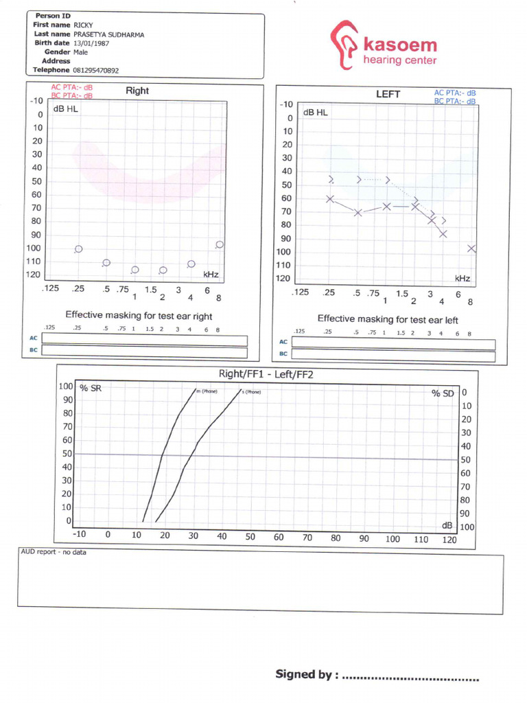 Audiogram Ri | PDF