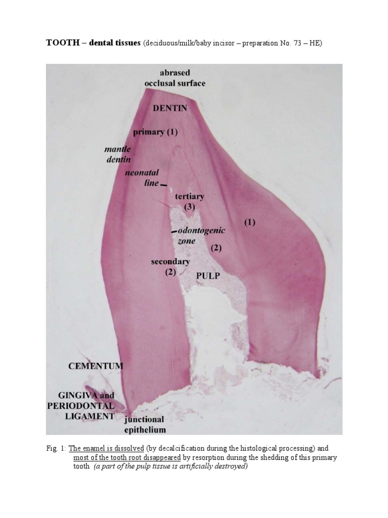 Histological Structure of Deciduous Teeth | PDF | Foreign Language ...