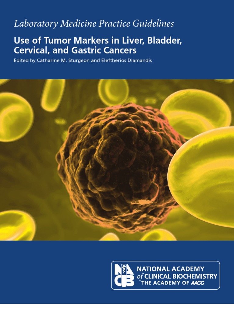 Liver Tumor Markers Guidelines Hepatitis Cirrhosis