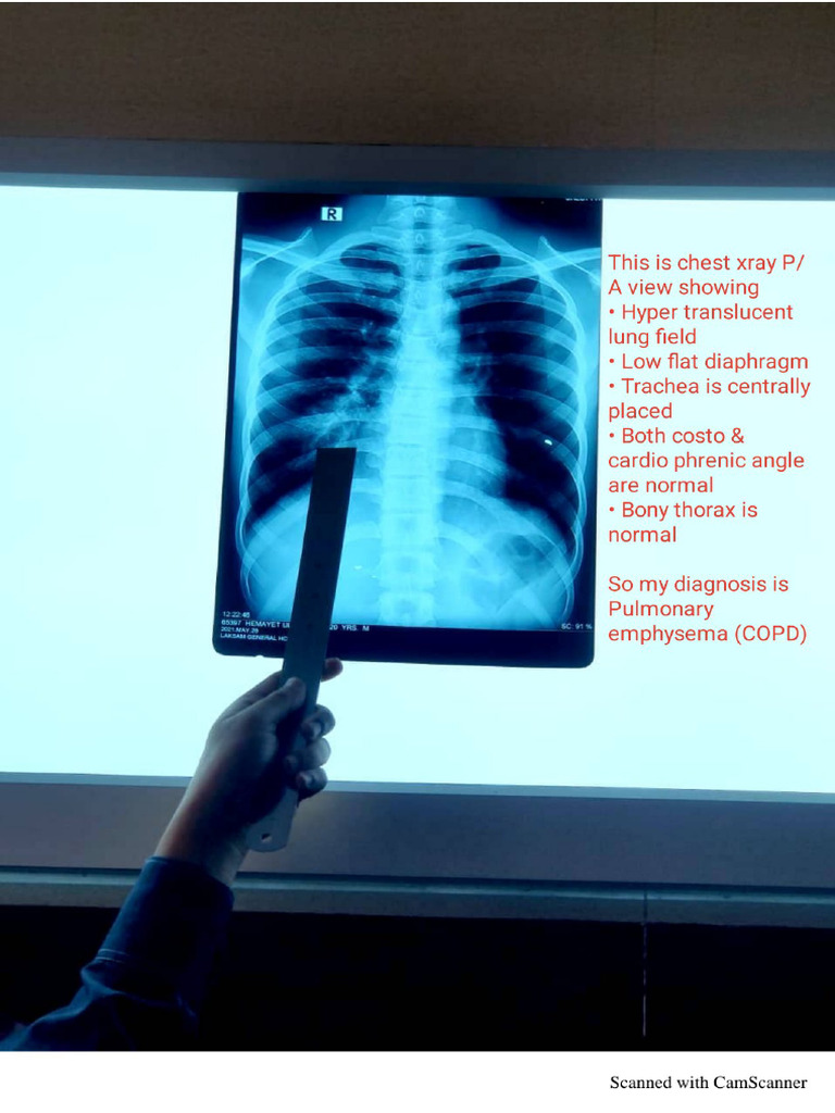 Medicine X-ray & ECG - Viva table | PDF