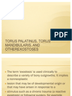 Torus Us Torus Mandibular Is, and Otherexostoses