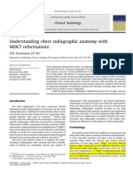 Understanding Chest Radiographic Anatomy with MDCT