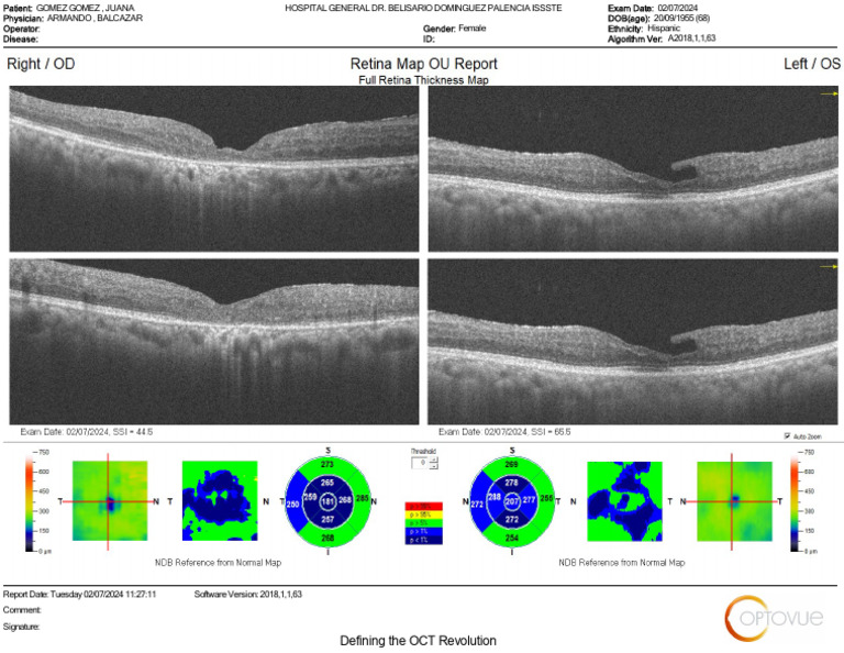 Retina Map Ou - 070941 | PDF | Ciencias sociales | Derecho