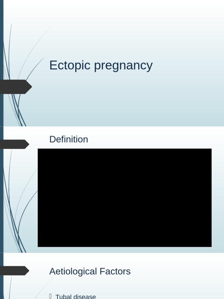 Ectopic Pregnancy | PDF