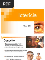 ictericia