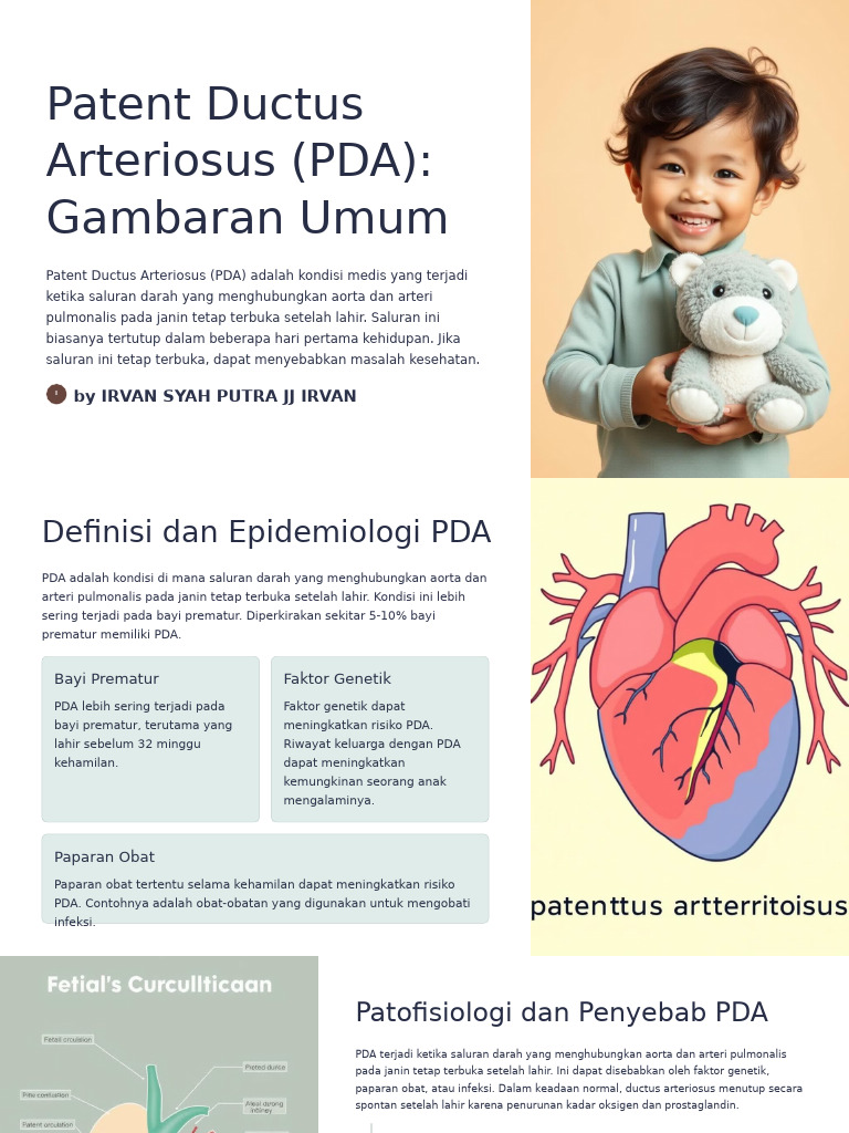 Patent Ductus Arteriosus PDA Gambaran Umum | PDF