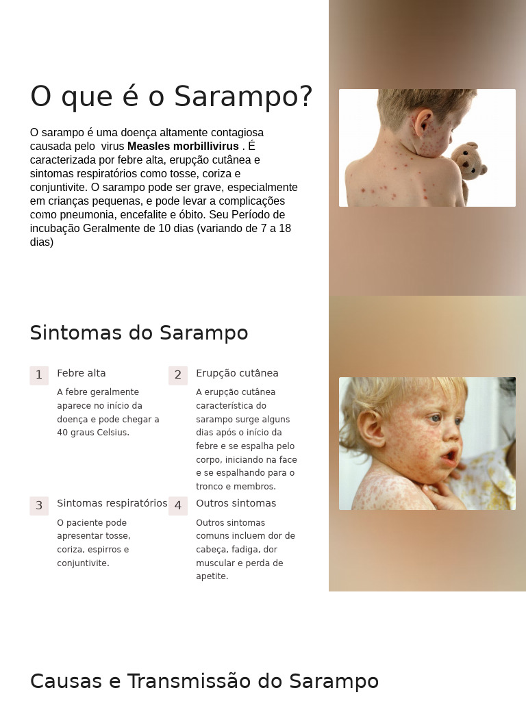 Sarampo | PDF