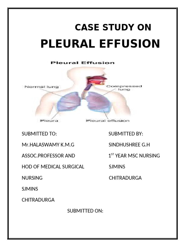 Case Study On Pleural Effusion | PDF