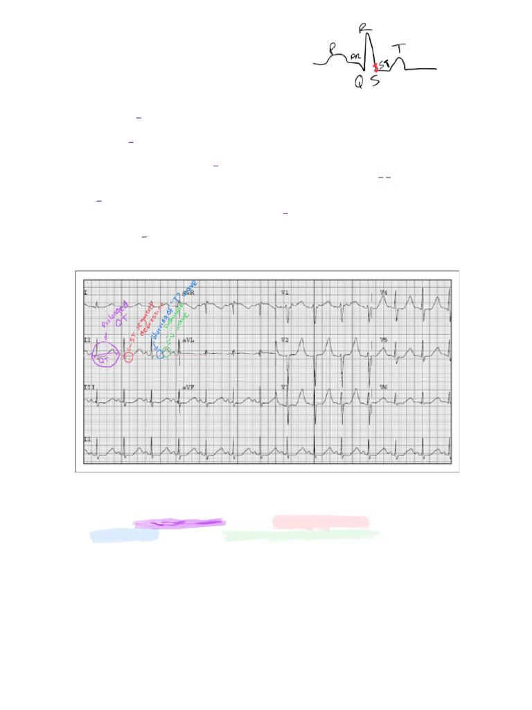 Ecg Diagnosis Hypokalemia And Hyperkalemia Pdf