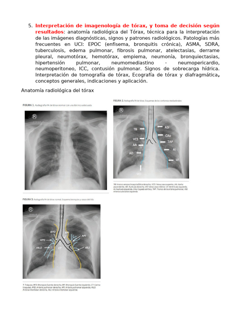 Interpretación RX Tema 5 | PDF