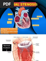 Download Mitral Stenosis by Muhammad Alauddin Sarwar SN7712244 doc pdf