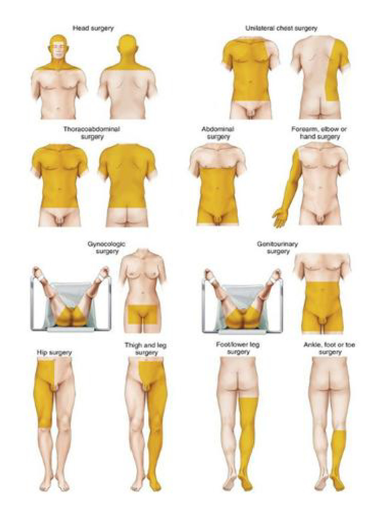 Types of Surgery | PDF