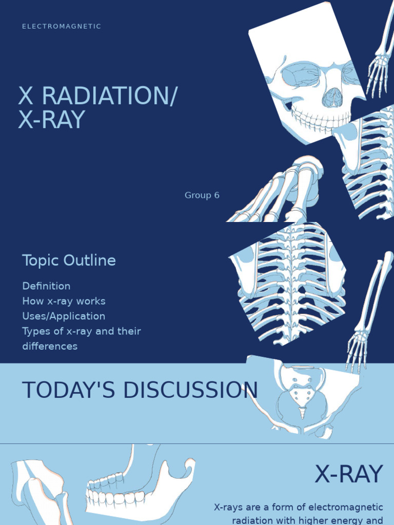 X Ray | PDF