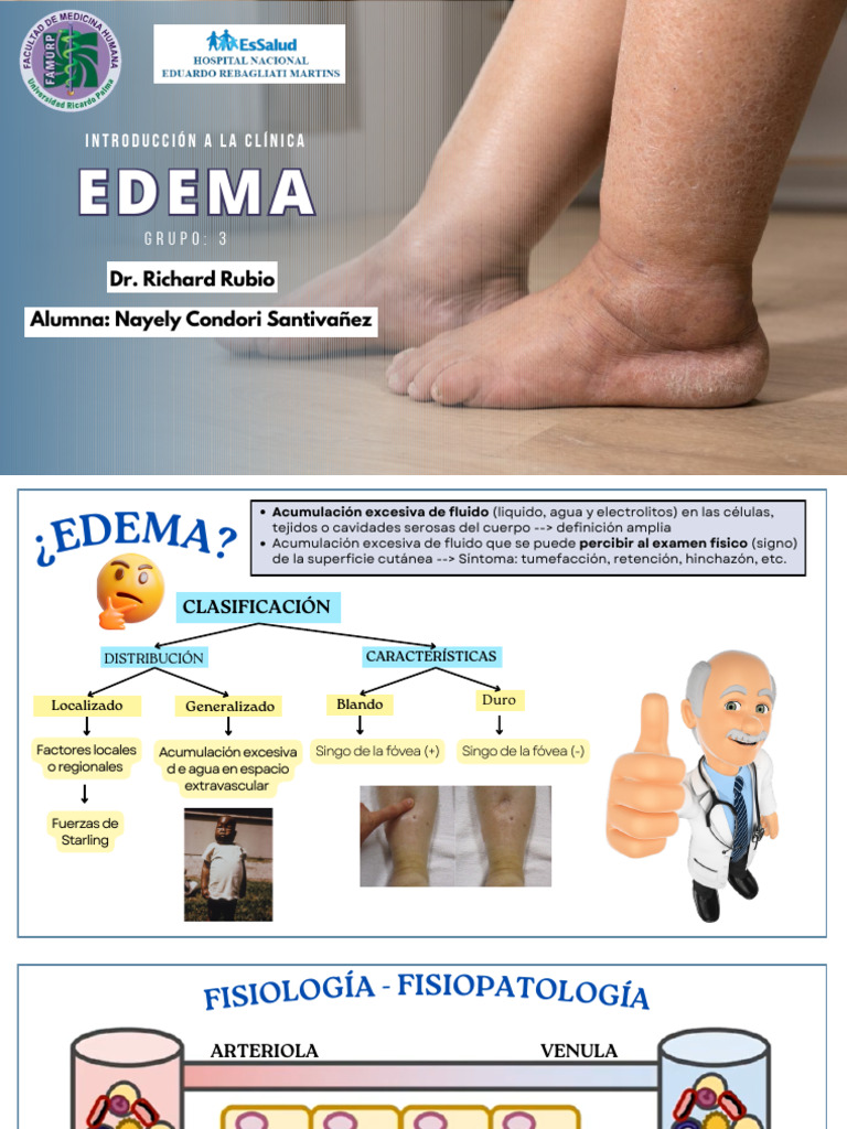 Edema Semiología | PDF