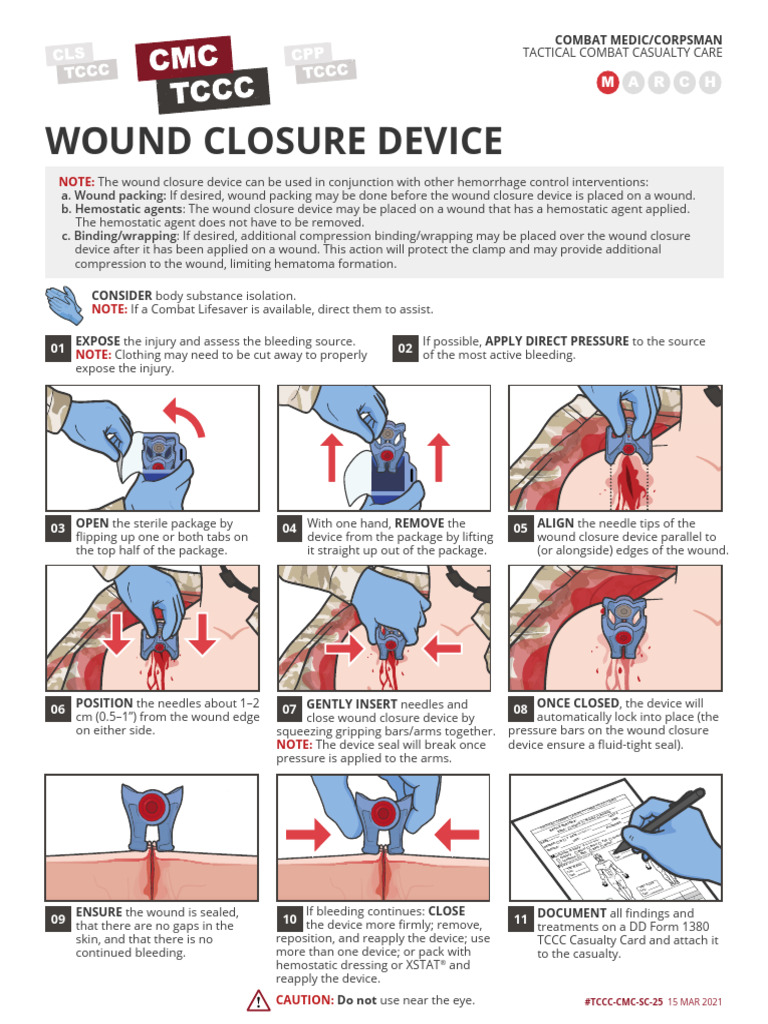 Skill Card Wound Closure Device en | PDF