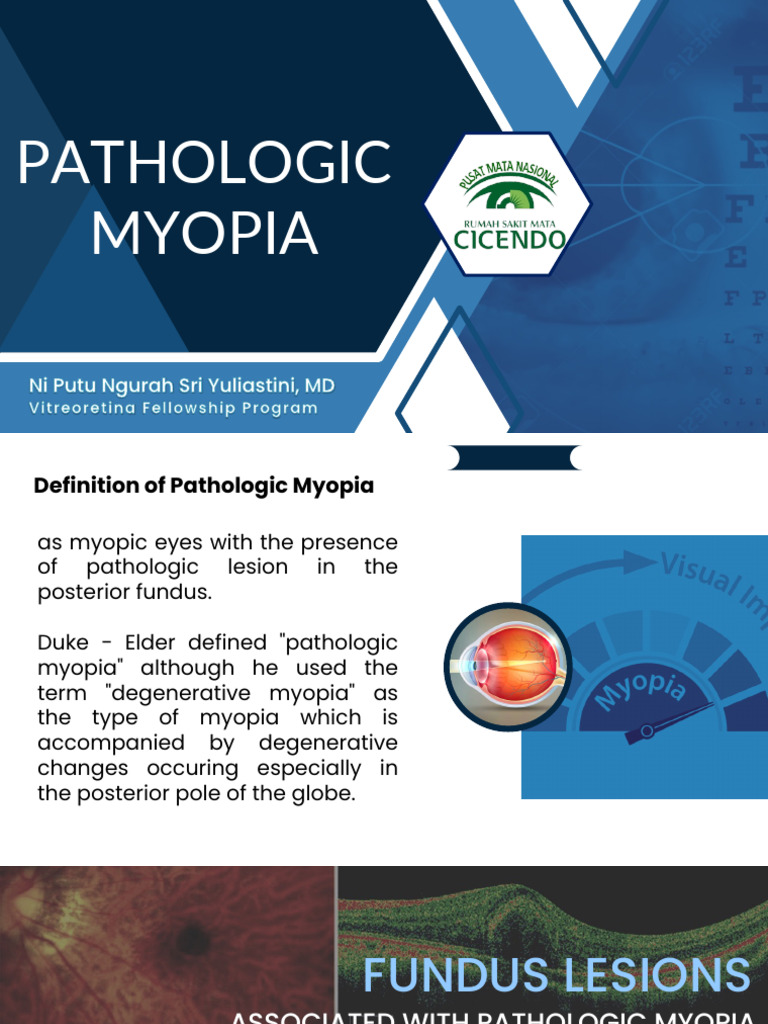 ILMIAH Pathologic Myopia | PDF