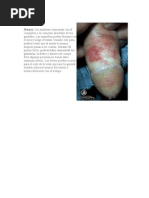 Download Herpes by anon-166537 SN7722058 doc pdf